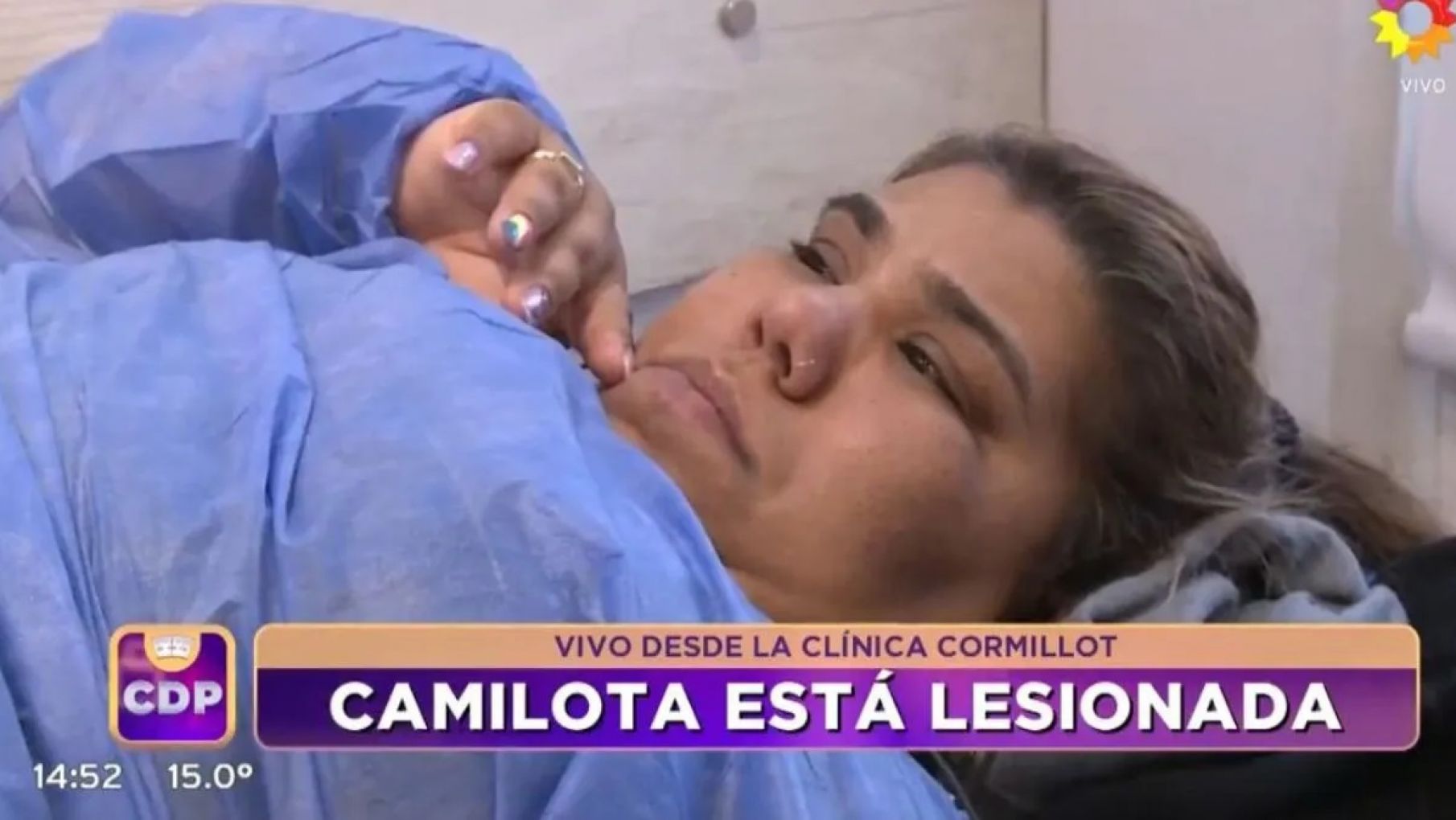 Camila de Cuestión de Peso tuvo una fuerte lesión y preocupa su continuidad